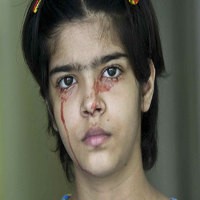 Aneh! Remaja India Terus Keluarkan Darah dari Mata, Hidung, Leher