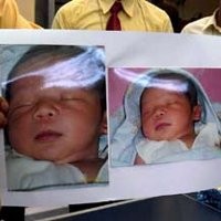 Kurang Cairan, Bayi Edy-Murtanti Dirujuk ke RS Anak Cengkareng