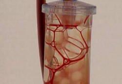 Tali Pusat Bayi Bisa Gantikan Cangkok Sumsum Tulang