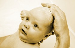 Cradle cap