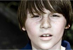 Stroke Bisa Menyerang Anak-anak