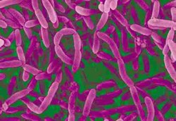 Manfaat Bakteri Baik di Usus