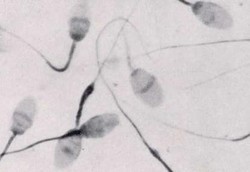 Menelan Sperma Bisa Bikin Awet Muda?