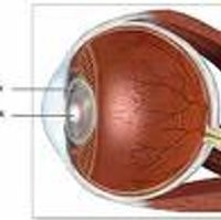 Cegah Invasi Cina, RS Mata Cicendo Gandeng Singapura 