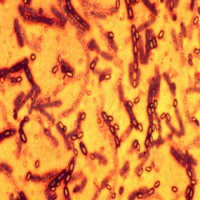 Pakai Heroin Terkontaminasi Anthrax, 8 Orang Tewas