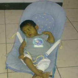 Kisah Bilqis, Bayi Pengidap Atresia Bilier