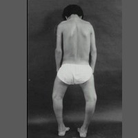 Keranjingan Ngegame Bisa Picu Kelainan Tulang