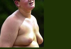 Dua Obat yang Bikin Payudara Pria Membesar