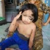 Fatihayah, Bocah Perempuan Diduga Berkelamin Ganda 