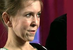 Gadis Cilik Berwajah Nenek-nenek Akibat Kelainan Genetik