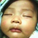 Almira Carrisa Orlyn, 3 Bulan; Perempuan; f