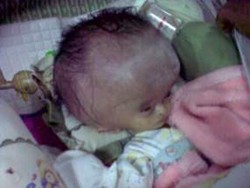 Hydrochepalus Disebabkan Virus Dari Hewan Peliharaan 