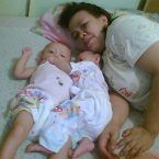 Kembar Riri & Rara, 9 Bulan; Perempuan; f