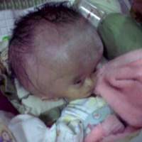 Seperti Toriq, Aura Juga Menanti Kemurahan Hati RSCM