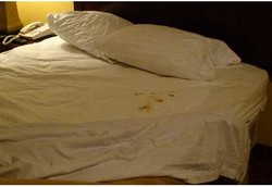 Tidur Bersama Jutaan Bakteri