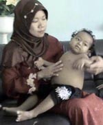 Orang Tua Bocah Kelainan Hati asal Malang Kirim Surat ke SBY