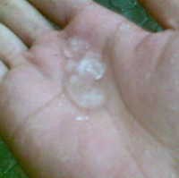 Bandung Diguyur Hujan Es