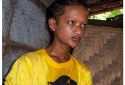 Keringat Tak Bisa Keluar, Remaja Pria Siraman Tiap 15 Menit