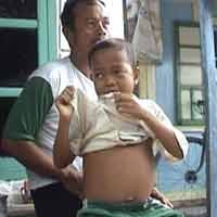 Sering Kambuh, Bastiawan Mengaku Sering Makan Genting