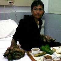 Kutil Dede Diperkirakan Menebal Kembali Dalam 8 Bulan