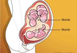 Seperti Apa Wanita Berahim Dua?