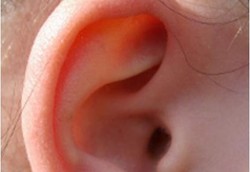 Kelas Musik Tajamkan Pendengaran Anak Usai Implan Koklea 