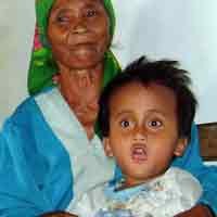 Bocah Penderita Hidrosefalus Ditelantarkan Ayah Kandung