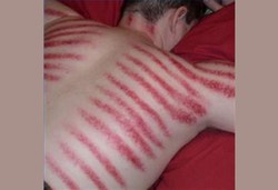 Adakah Penyakit Masuk Angin?