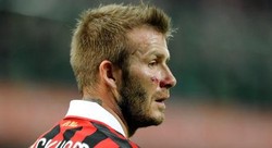 Goodbye, Becks