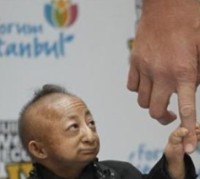 Komplikasi Jantung, Manusia Terpendek di Dunia Meninggal 