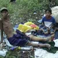 Diusir Keluarga, Penderita Kusta Hidup di Hutan dengan Anak Angkat