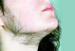 Perempuan-perempuan Berbulu