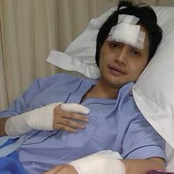 Ultah, Eddies Adelia Kena Ledakan Gas