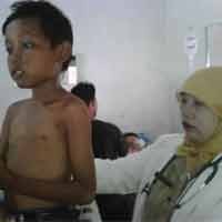 Kusta Fani Dirawat dan Diobati