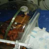 Bayi Imatur Seberat 700 Gram Lahir di Madiun