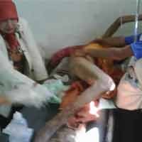 Penderita Kusta akan Dirujuk ke RS Glagah Mojokerto