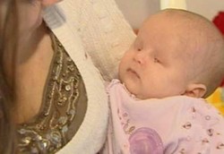 USG Gagal Deteksi Bayi Tanpa Mata