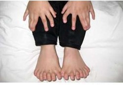 Bocah Punya 31 Jari Tangan dan Kaki