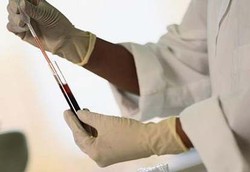 Mengecek Kondisi Darah