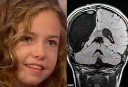 Impian Bocah Berotak Sebelah Menjadi Balerina 