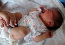 Penyebab Diare Pada Bayi