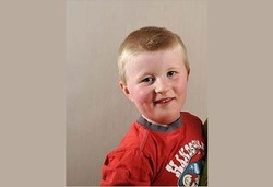 Tak Bisa Bicara Karena Punya Gen Langka di Dunia