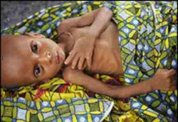 1,5 Juta Balita Terancam Goblok Permanen