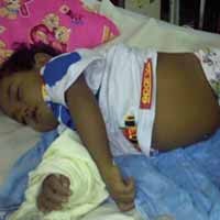 Eka Putra, Bocah Kelainan Hati Asal Malang Meninggal