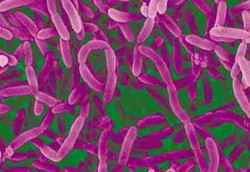 Bakteri yang Bikin Langsing