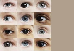 Melihat Kadar Kolesterol dari Mata