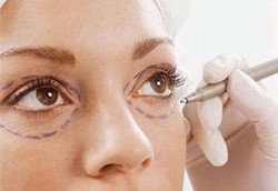 Operasi Plastik Bikin Kecanduan