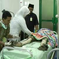 Kompor Meledak, Pasutri Alami Luka Bakar