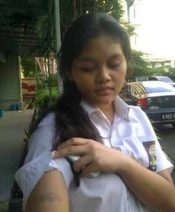 Polisi Akan Selidiki Dugaan Penganiayaan Terhadap Vhia