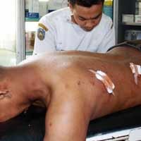 Deny Jadi Manusia Kerikil Setelah Kompresor di Dekatnya Meledak